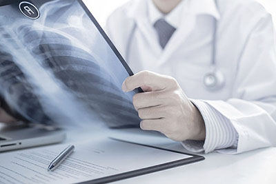Personal Injury Law